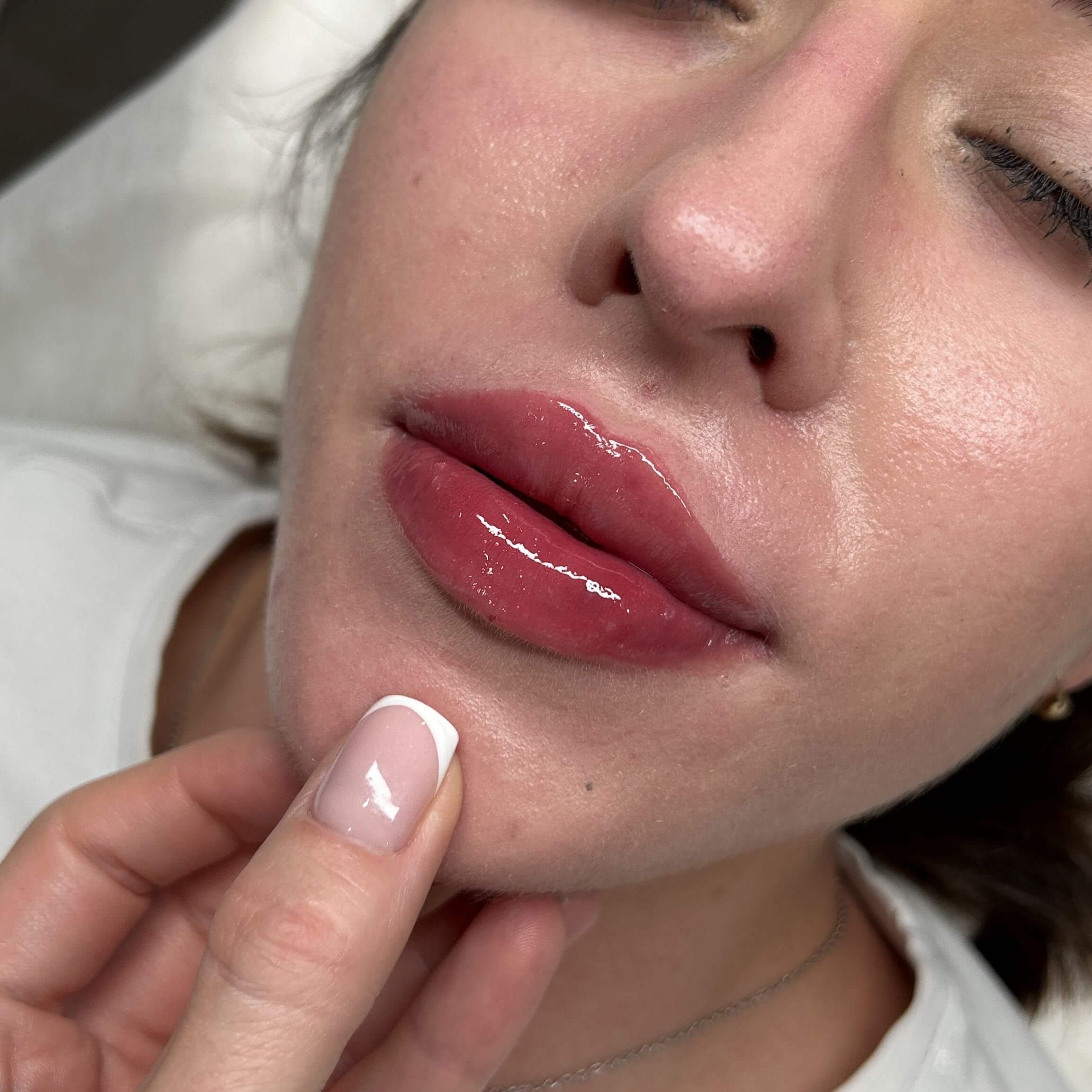 Powiększanie ust Głogów efekty przed i po - AK Beauty CLUB Natural Lips